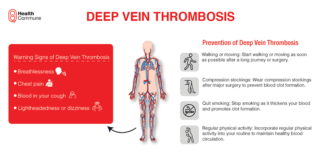 Deep Vein Thrombosis ()