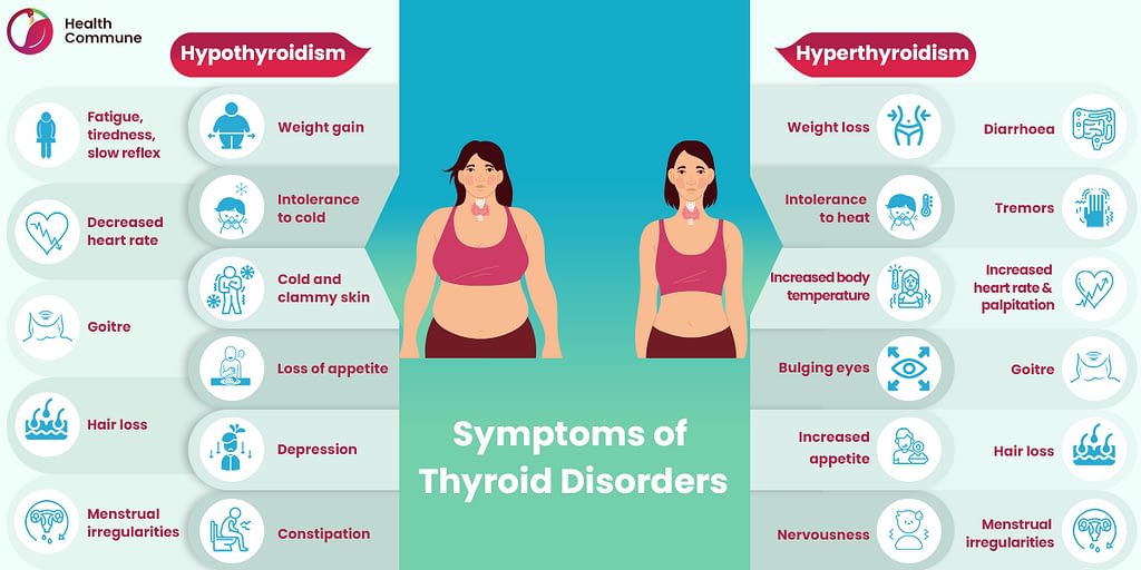 14. Symptoms of thyroid disorders
