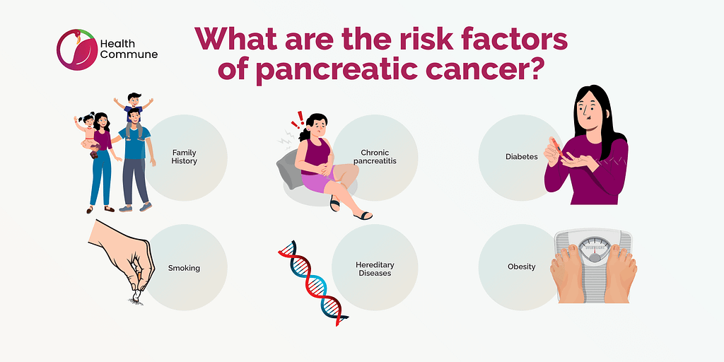 47. Pancreatic Cancer