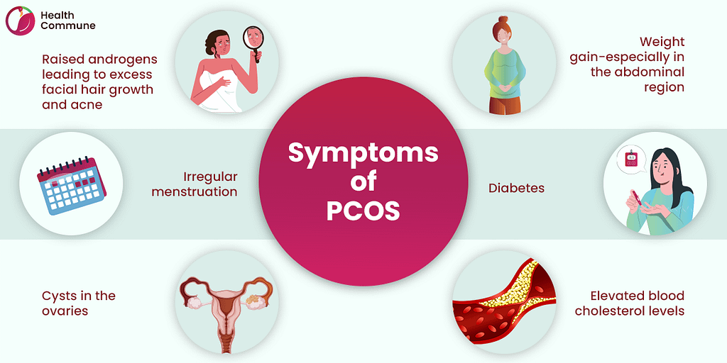 53. Symptoms of PCOS