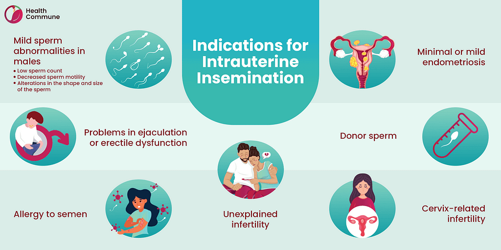 55. Indications for Intrauterine Insemination