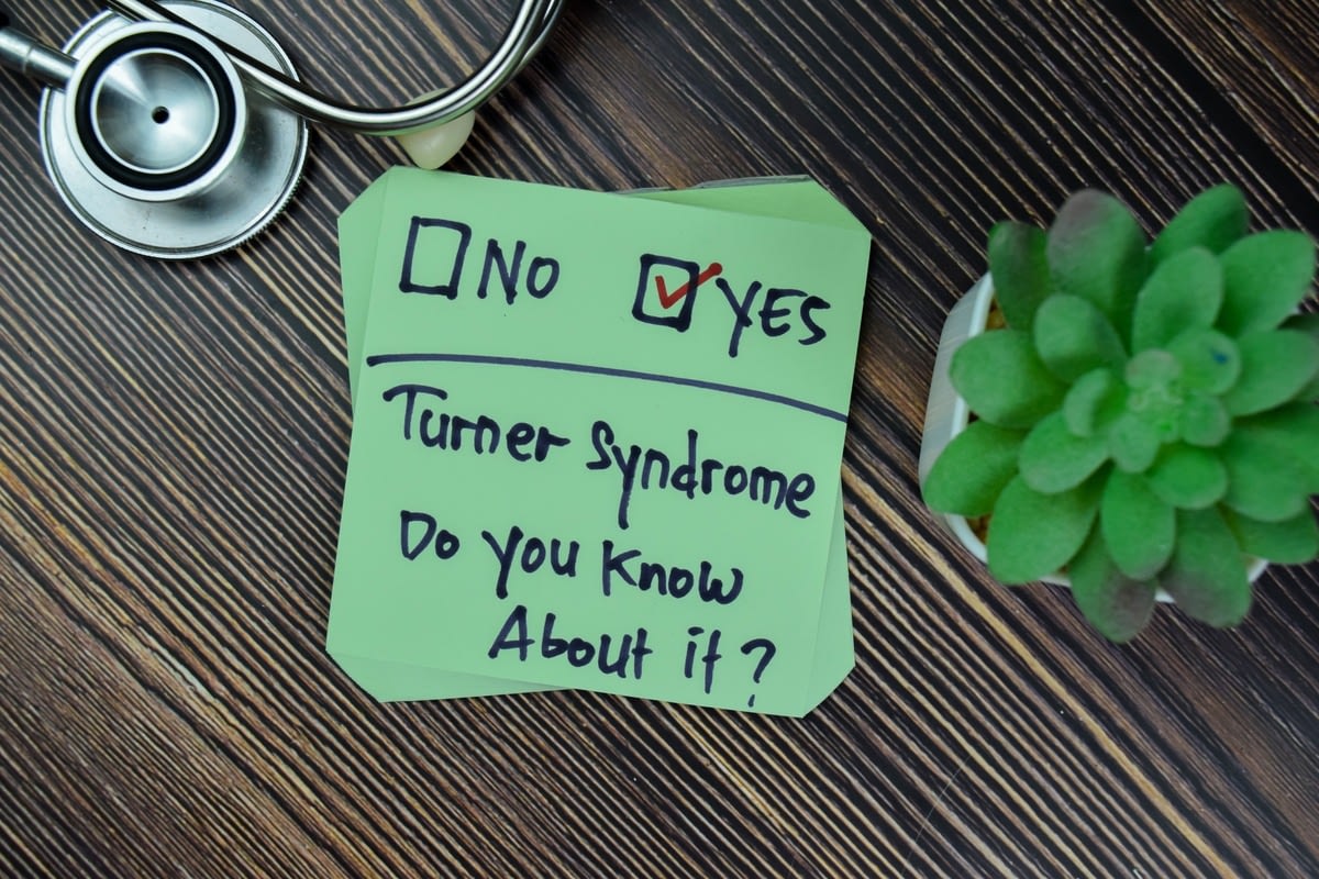 Turners syndrome